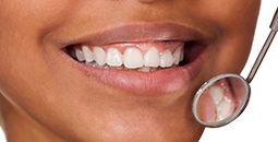 Closeup of gorgeous smile with metal free restorations